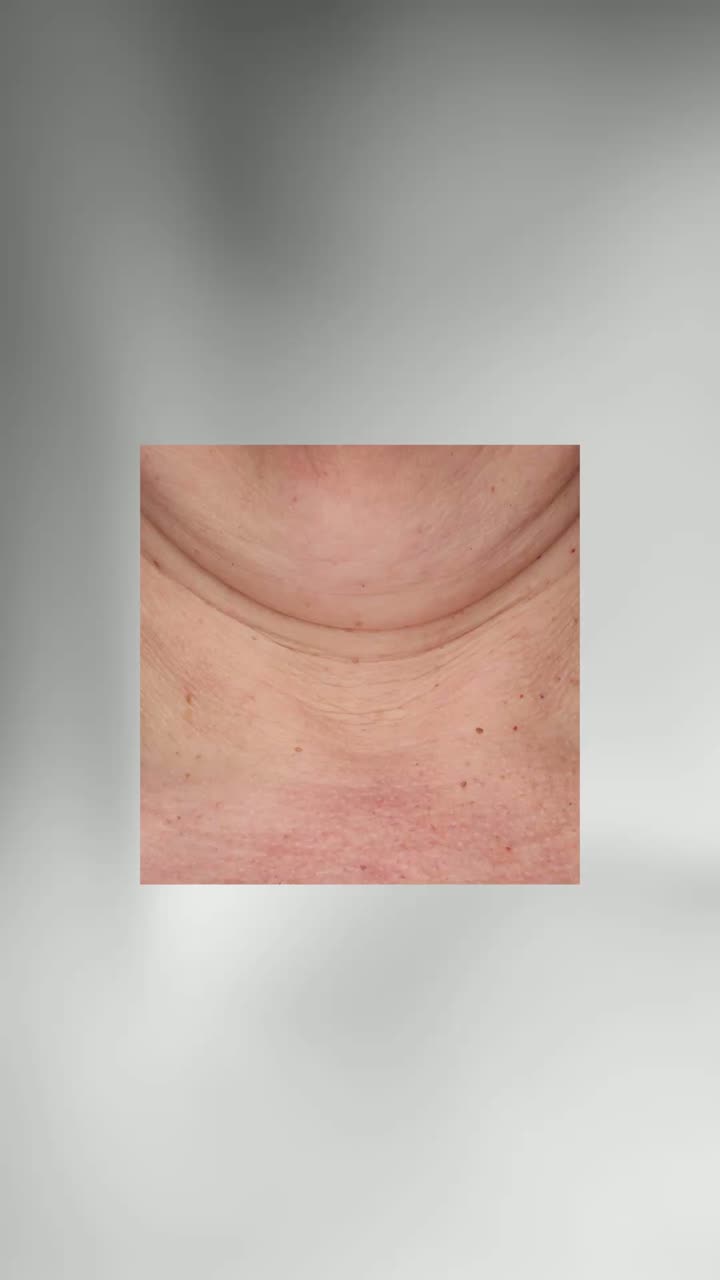 Neck Complex for neck & décolleté (ZO®)